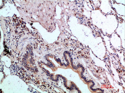 ASCL1 rabbit pAb