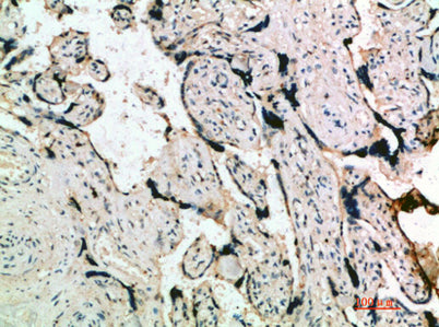 Inhibin α rabbit pAb