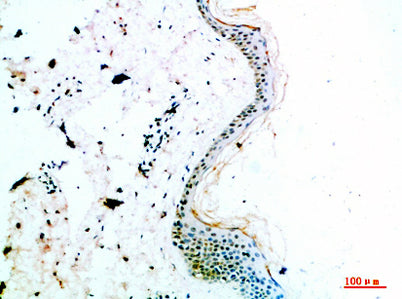 COL14A1 rabbit pAb
