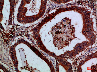 Cystatin B rabbit pAb