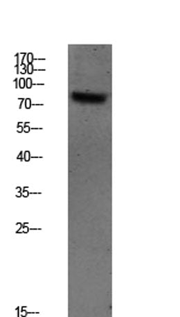 SYK (Phospho-Tyr348) Rabbit pAb