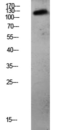 CDH3 rabbit pAb