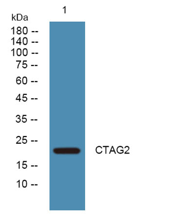 CTAG2 rabbit pAb