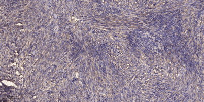 DYHC1 rabbit pAb