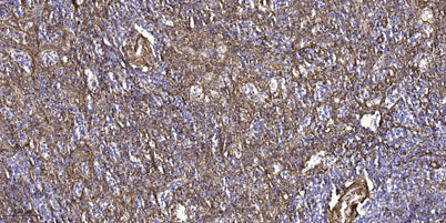 MYO15 rabbit pAb