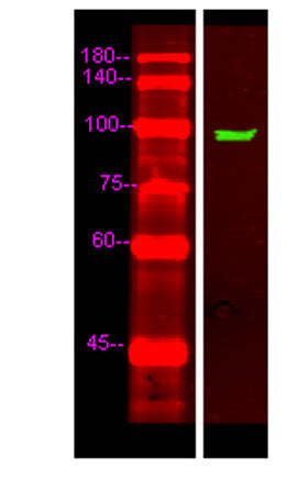 UNC5C rabbit pAb