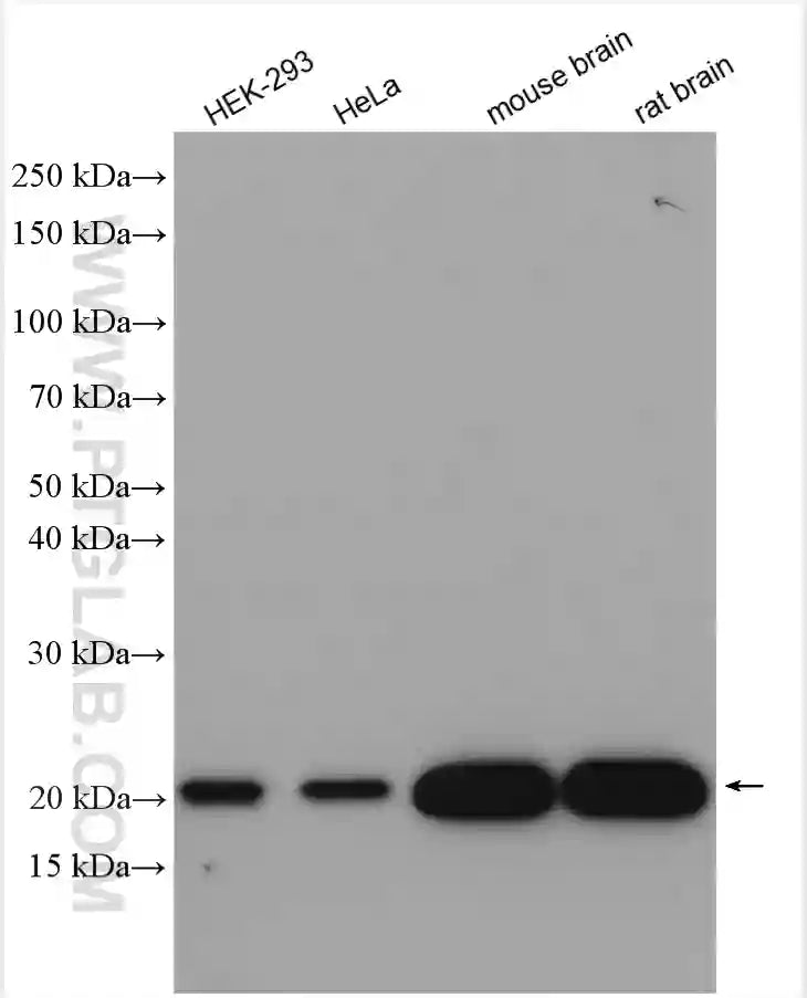 KRAS Polyclonal antibody