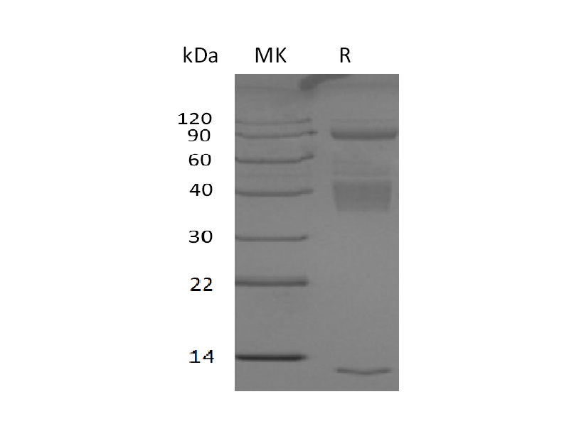 Recombinant Human Latent TGF Beta-1&GARP Complex Protein (N-6His, C-3*Strep)