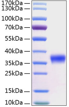 Recombinant Human Kallikrein-8/KLK8 Protein