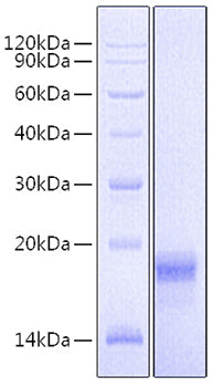 Recombinant Mouse VEGF-D/FIGF Protein