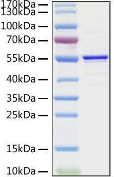Recombinant SARS-CoV Nucleocapsid Protein