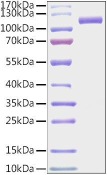 Recombinant Mouse CD318 Protein