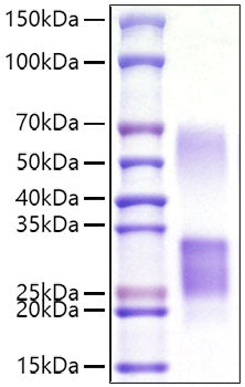 Recombinant Mouse CD69 Protein