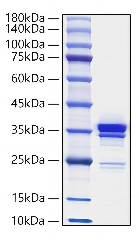 Recombinant Mouse HMGB1 Protein