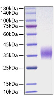 Recombinant Mouse Oncostatin-M/OSM Protein