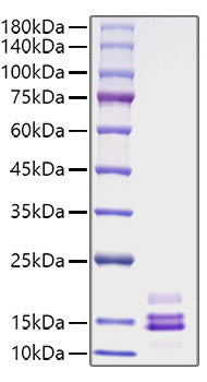 Recombinant Human CCL2/MCP-1 Protein