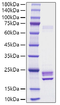 Recombinant Rat IL-1 alpha/Il1a Protein