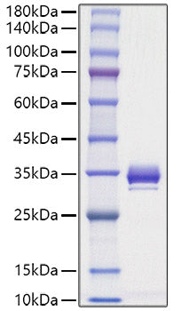 Recombinant Mouse Angiopoietin-1/ANG-1/ANGPT1 Protein