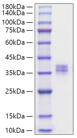 Recombinant Human MMP7/MPSL1/PUMP1 Protein