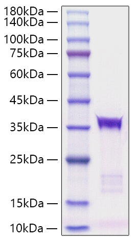 Recombinant human IGFBP5/IGFBP-5 Protein