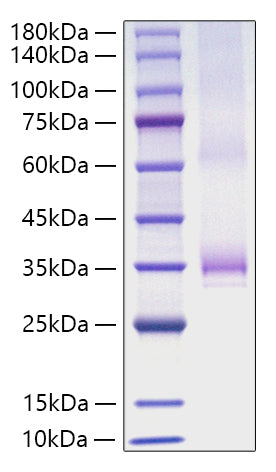 Recombinant Human Angiopoietin-1/ANG-1/ANGPT1 Protein