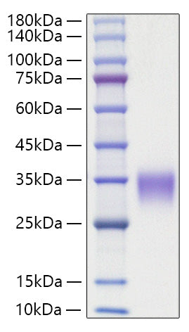 Recombinant Rat Oncostatin-M/OSM Protein