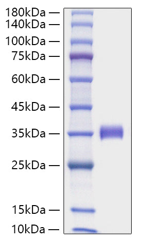 Recombinant Human Angiopoietin-2/ANGPT2 Protein