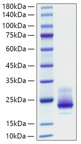 Recombinant Human TRAIL-R1/CD261 Protein