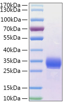 Recombinant Human Angiopoietin-like 4/ANGPTL4 Protein