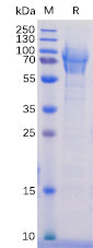 Recombinant Human SELPLG/CD162 Protein