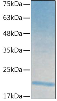 Recombinant Human IL-21 Protein