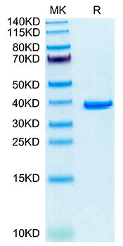 Recombinant Human ANXA2 Protein