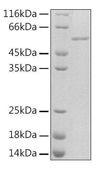 Recombinant Rat Serpin E1 Protein