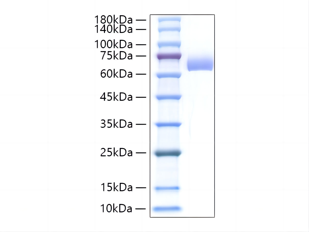 Recombinant Mouse Alkaline phosphatase Protein