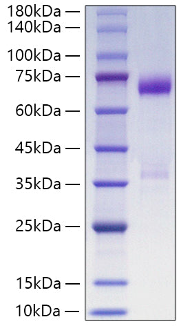 Recombinant Human Angiopoietin-like 3/ANGPTL3 Protein