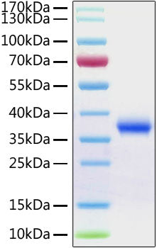 Recombinant Human Aldehyde reductase/AKR1B1 Protein