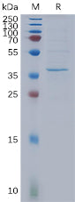 Recombinant Human HSD17B13 Protein