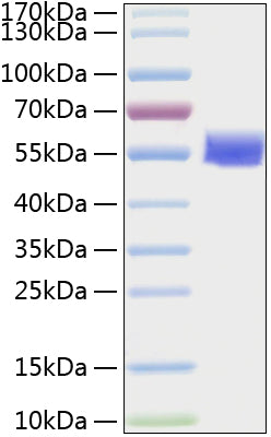 Recombinant Human Vimentin Protein