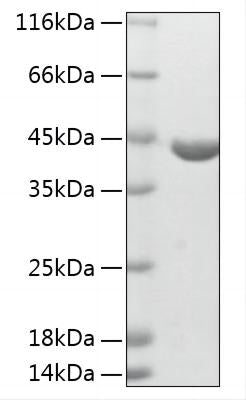 Recombinant Human ABHD4 Protein