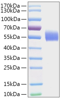 Recombinant Human DPYS Protein
