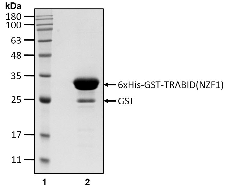 Recombinant Human Ubiquitin thioesterase ZRANB1 protein