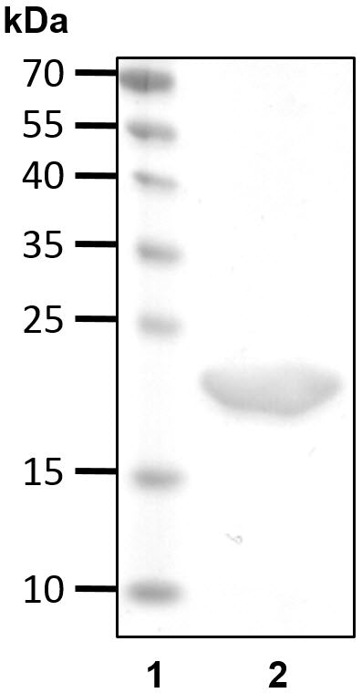 Recombinant Human NEMO (UBAN)/IKBKG protein