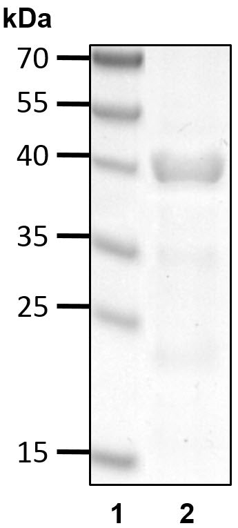 Recombinant Human NEMO (UBAN)/IKBKG protein