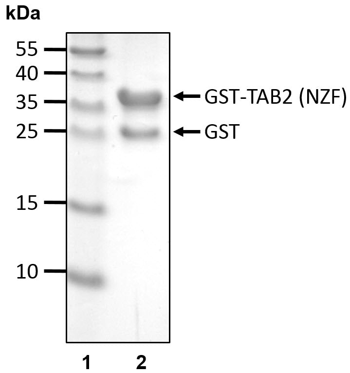 Recombinant Human TAK1-binding protein 2/TAB-2(627-693) (NZF) protein