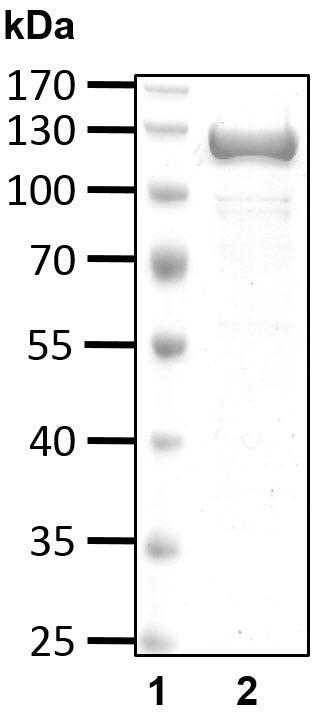 Recombinant Human Ubiquitin-protein ligase E3A/UBE3A protein