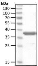 Recombinant Human ZnF-UBP/USP5 protein