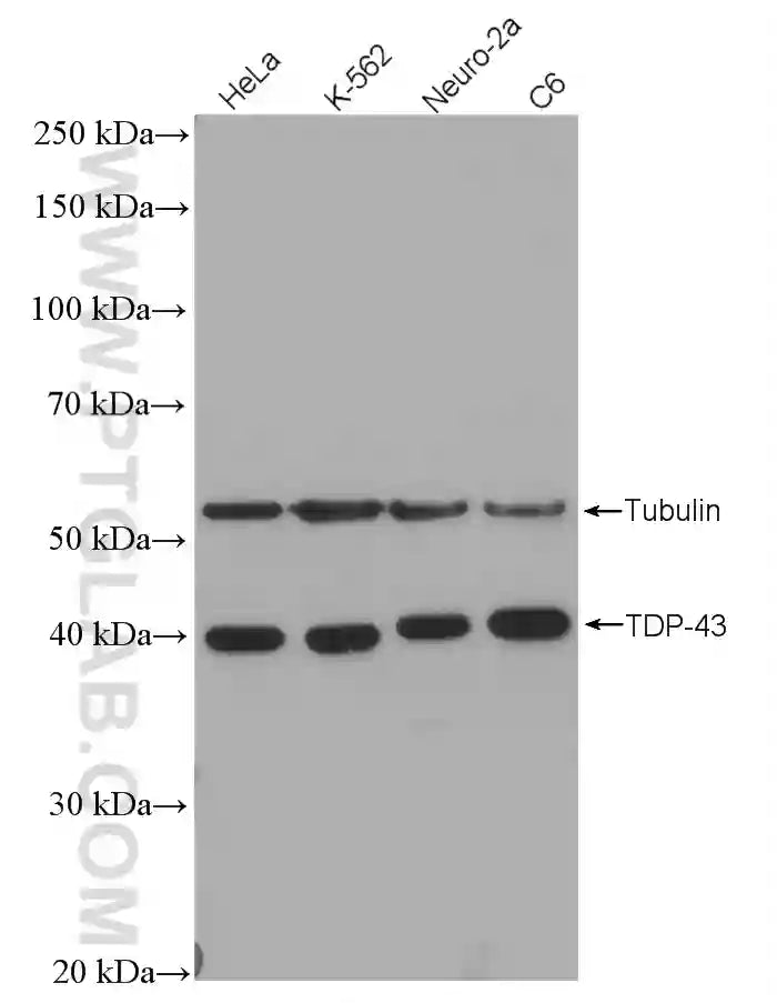 TDP-43 Recombinant antibody