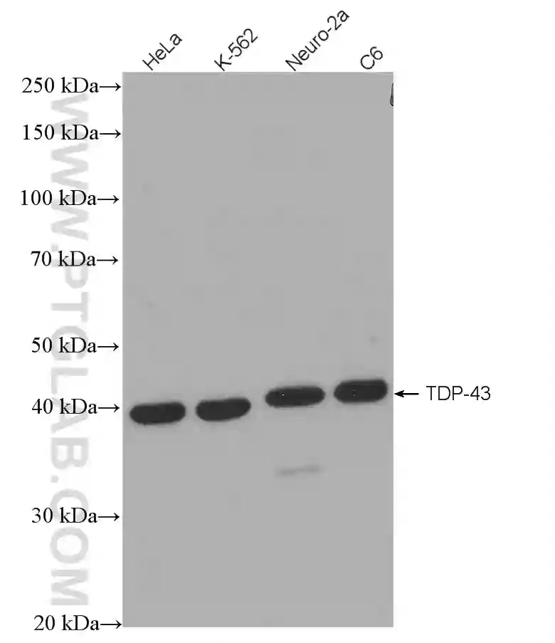 TDP-43 Recombinant antibody