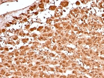 Recombinant Aldose reductase 1B1 Antibody / AKR1B1