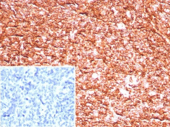 IHC staining of FFPE human tonsil tissue with HLA 1 ABC antibody (clone MHC-I/8147R). Inset: PBS use